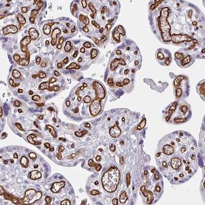 Immunohistochemistry-Paraffin: CD34 Antibody [NBP2-38321]