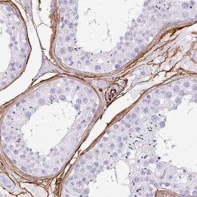 Immunohistochemistry-Paraffin: CD34 Antibody [NBP2-38321]