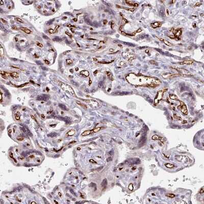 Immunohistochemistry-Paraffin: CD34 Antibody [NBP2-38322]