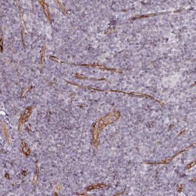 Immunohistochemistry-Paraffin: CD34 Antibody [NBP2-38322]