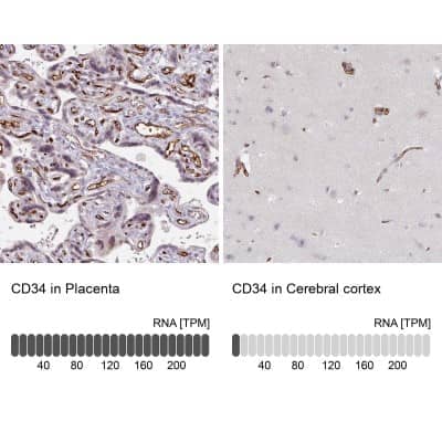 Immunohistochemistry-Paraffin: CD34 Antibody [NBP2-38322]