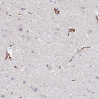 Immunohistochemistry-Paraffin: CD34 Antibody [NBP2-38322]