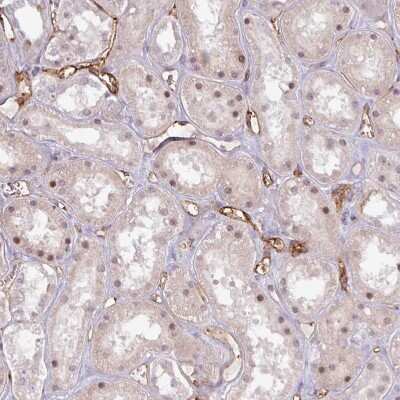 Immunohistochemistry-Paraffin: CD34 Antibody [NBP2-38322]