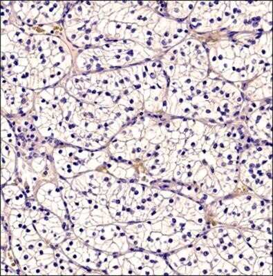 Immunocytochemistry: CD34 Antibody (MEC 14.7) - Azide and BSA Free [NBP2-80642]