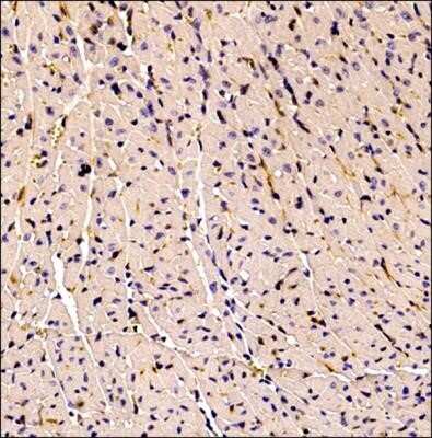 Immunohistochemistry: CD34 Antibody (MEC 14.7) - Azide and BSA Free [NBP2-80642]
