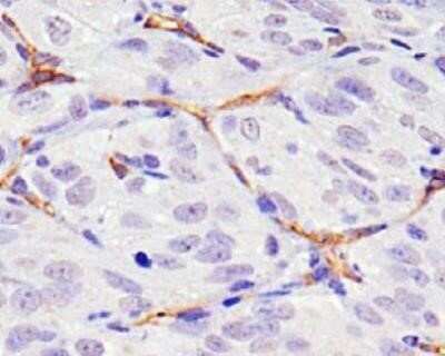 Immunohistochemistry: CD34 Antibody (MEC 14.7) - Azide and BSA Free [NBP2-80642]
