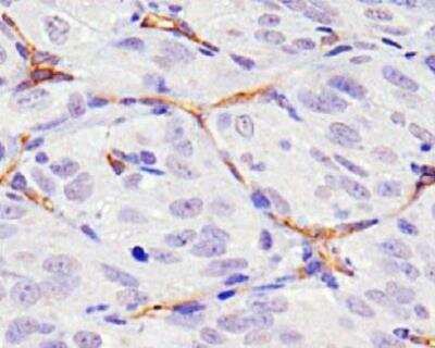 Immunohistochemistry-Paraffin: CD34 Antibody (MEC 14.7) [NB600-1071]
