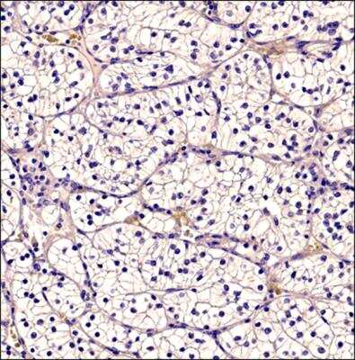 Immunohistochemistry-Paraffin: CD34 Antibody (MEC 14.7) [NB600-1071]