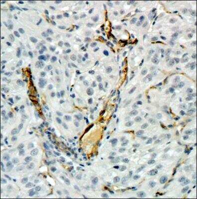 Immunohistochemistry-Paraffin: CD34 Antibody (MEC 14.7) [NB600-1071]