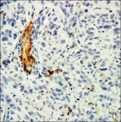 Immunohistochemistry-Paraffin: CD34 Antibody (MEC 14.7) [NB600-1071]
