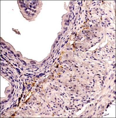 Immunohistochemistry-Paraffin: CD34 Antibody (MEC 14.7) [NB600-1071]