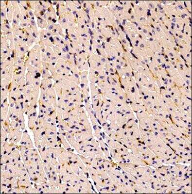 Immunohistochemistry-Paraffin: CD34 Antibody (MEC 14.7) [NB600-1071]