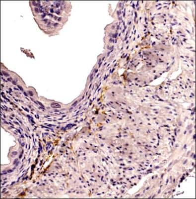 Immunohistochemistry-Paraffin: CD34 Antibody (MEC 14.7) [NB600-1071]