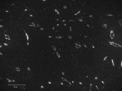 Immunohistochemistry-Paraffin: CD34 Antibody (QBEnd/10 + HPCA1/763) - Azide and BSA Free [NBP2-47909]