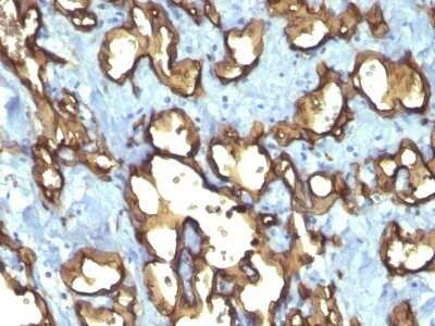 Immunohistochemistry-Paraffin: CD34 Antibody (QBEnd/10 + HPCA1/763) - Azide and BSA Free [NBP2-47909]