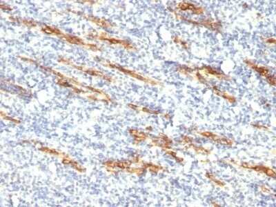 Immunohistochemistry-Paraffin: CD34 Antibody (QBEnd/10 + HPCA1/763) - Azide and BSA Free [NBP2-47909]