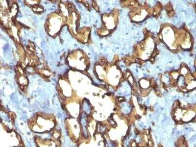 Immunohistochemistry-Paraffin: CD34 Antibody (QBEnd/10 + HPCA1/763) - IHC-Prediluted [NBP2-48362]