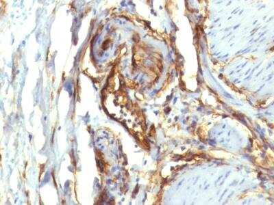 Immunohistochemistry-Paraffin: CD34 Antibody (QBEnd/10 + HPCA1/763) - IHC-Prediluted [NBP2-48362]
