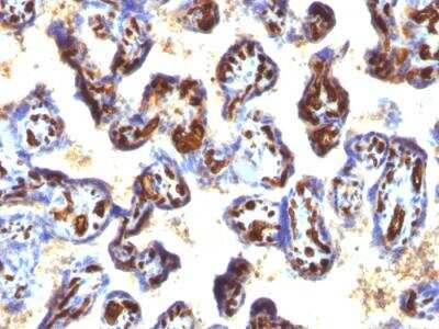 Immunohistochemistry-Paraffin: CD34 Antibody (QBEnd/10 + HPCA1/763) - IHC-Prediluted [NBP2-48362]