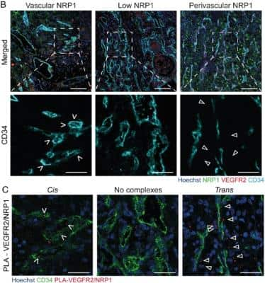 Immunohistochemistry: CD34 Antibody (QBEnd/10 + HPCA1/763) [NBP2-44567]