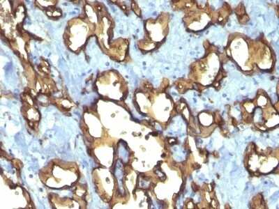 Immunohistochemistry-Paraffin: CD34 Antibody (QBEnd/10 + HPCA1/763) [NBP2-44567]