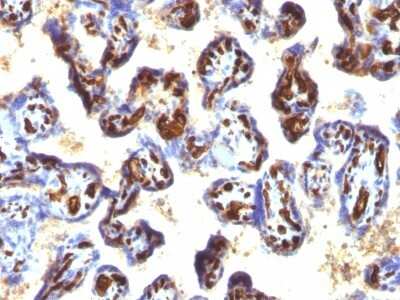 Immunohistochemistry-Paraffin: CD34 Antibody (QBEnd/10 + HPCA1/763) [NBP2-44567]