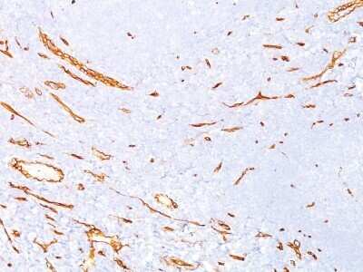 Immunohistochemistry-Paraffin: CD34 Antibody (QBEnd/10) - Azide and BSA Free [NBP2-34713]