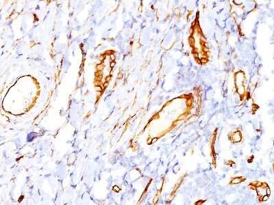 Immunohistochemistry-Paraffin: CD34 Antibody (QBEnd/10) - Azide and BSA Free [NBP2-34713]