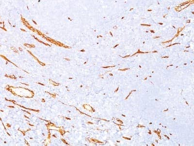 Immunohistochemistry-Paraffin: CD34 Antibody (QBEnd/10) - BSA Free [NBP2-32932]