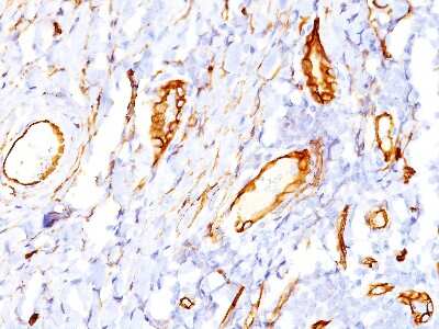 Immunohistochemistry-Paraffin: CD34 Antibody (QBEnd/10) - BSA Free [NBP2-32932]