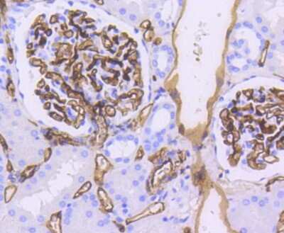 Immunohistochemistry-Paraffin: CD34 Antibody (SI16-01) [NBP2-67399]
