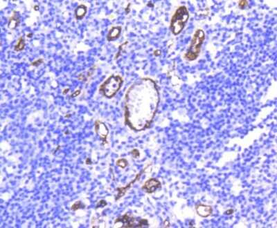 Immunohistochemistry-Paraffin: CD34 Antibody (SI16-01) [NBP2-67399]