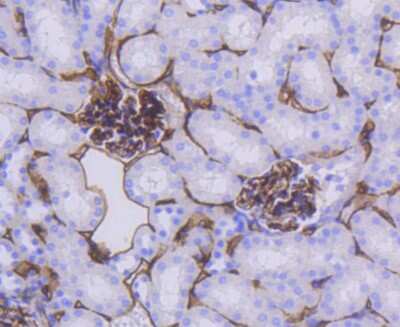 Immunohistochemistry-Paraffin: CD34 Antibody (SI16-01) [NBP2-67399]