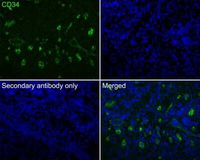 Immunohistochemistry-Paraffin: CD34 Antibody (SI16-01) [NBP2-67399]