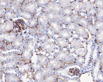 Immunohistochemistry-Paraffin: CD34 Antibody (SI16-01) [NBP2-67399]