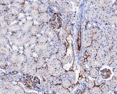 Immunohistochemistry-Paraffin: CD34 Antibody (SI16-01) [NBP2-67399]
