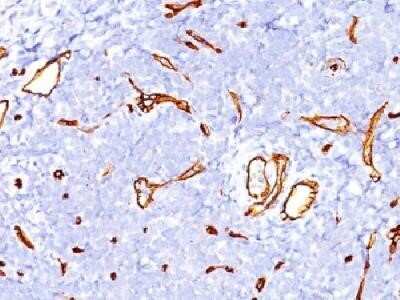 Immunohistochemistry-Paraffin: CD34 Antibody (SPM123) - Azide and BSA Free [NBP2-34733]