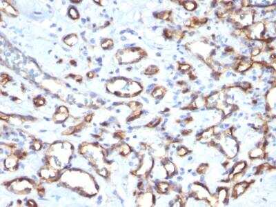 Immunohistochemistry-Paraffin: CD34 Antibody (SPM610) - IHC-Prediluted [NBP2-48364]