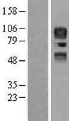 Western Blot: CD34 Overexpression Lysate [NBP2-09777]