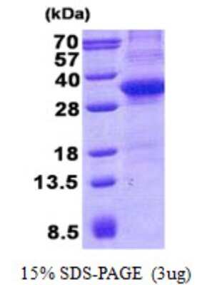 SDS-PAGE: Recombinant Human CD34 His Protein [NBP2-22751]