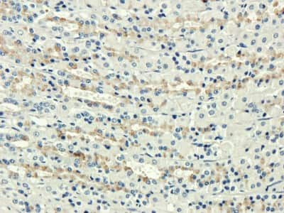 Immunohistochemistry: CD35 Antibody (7G6) - Chimeric - Azide and BSA Free [NBP2-52667]