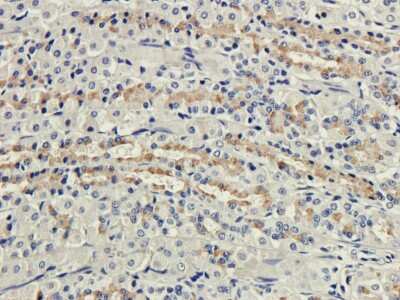 Immunohistochemistry: CD35 Antibody (8C12) - Chimeric - Azide and BSA Free [NBP2-52668]