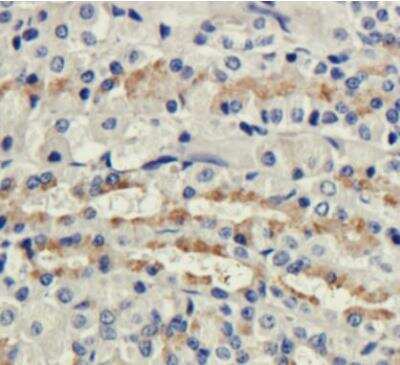 Immunohistochemistry: CD35 Antibody (8C12) - Azide and BSA Free [NBP2-81049]