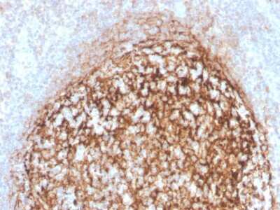 Immunohistochemistry-Paraffin: CD35 Antibody (CR1/4382R) - Azide and BSA Free [NBP3-08296]