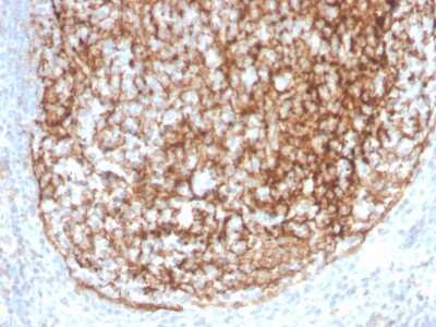 Immunohistochemistry-Paraffin: CD35 Antibody (CR1/4382R) - Azide and BSA Free [NBP3-08296]