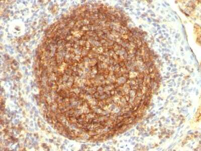 Immunohistochemistry-Paraffin: CD35 Antibody (CR1/802) - Azide and BSA Free [NBP2-47865]