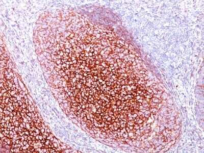Immunohistochemistry-Paraffin: CD35 Antibody (CR1/802) [NBP2-44619]
