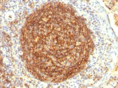 Immunohistochemistry-Paraffin: CD35 Antibody (CR1/802) [NBP2-44619]