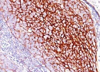 Immunohistochemistry-Paraffin: CD35 Antibody (E11) - Azide and BSA Free [NBP2-33080]