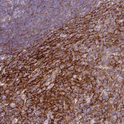 Immunohistochemistry-Paraffin: CD35 Antibody [NBP2-13870]